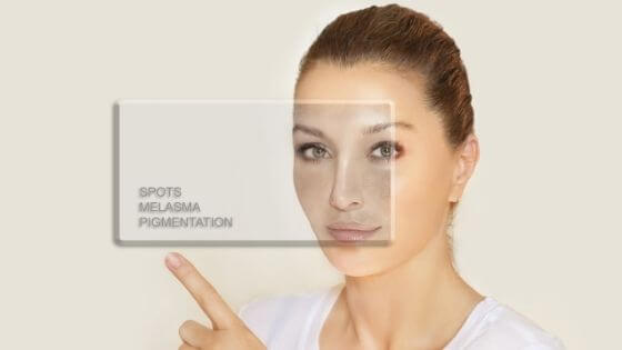 how to remove a dark spot naturally