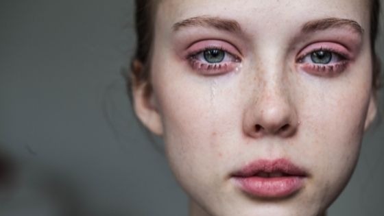 woman with her eyes burning while crying
